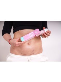 Momcare Császármetszés hegápoló krém 50ml