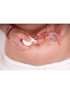 Momcare Császármetszés hegápoló krém 50ml