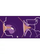 Avent Ultra Comfort egyes elektromos mellszívó